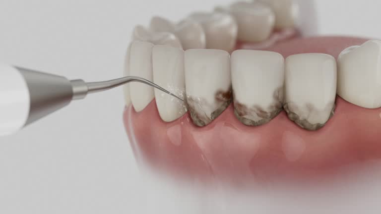 Reliable Emergency Dentist contractor in Tipton, IN by Smile Center Dentistry
